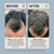 Actiiv Recover Thickening Shampoo Treatment for Men